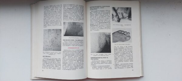 Z. Šťáva & L. Jirásek & R. Schwank & J. Trapl,: Dermatovenerologie, 1977